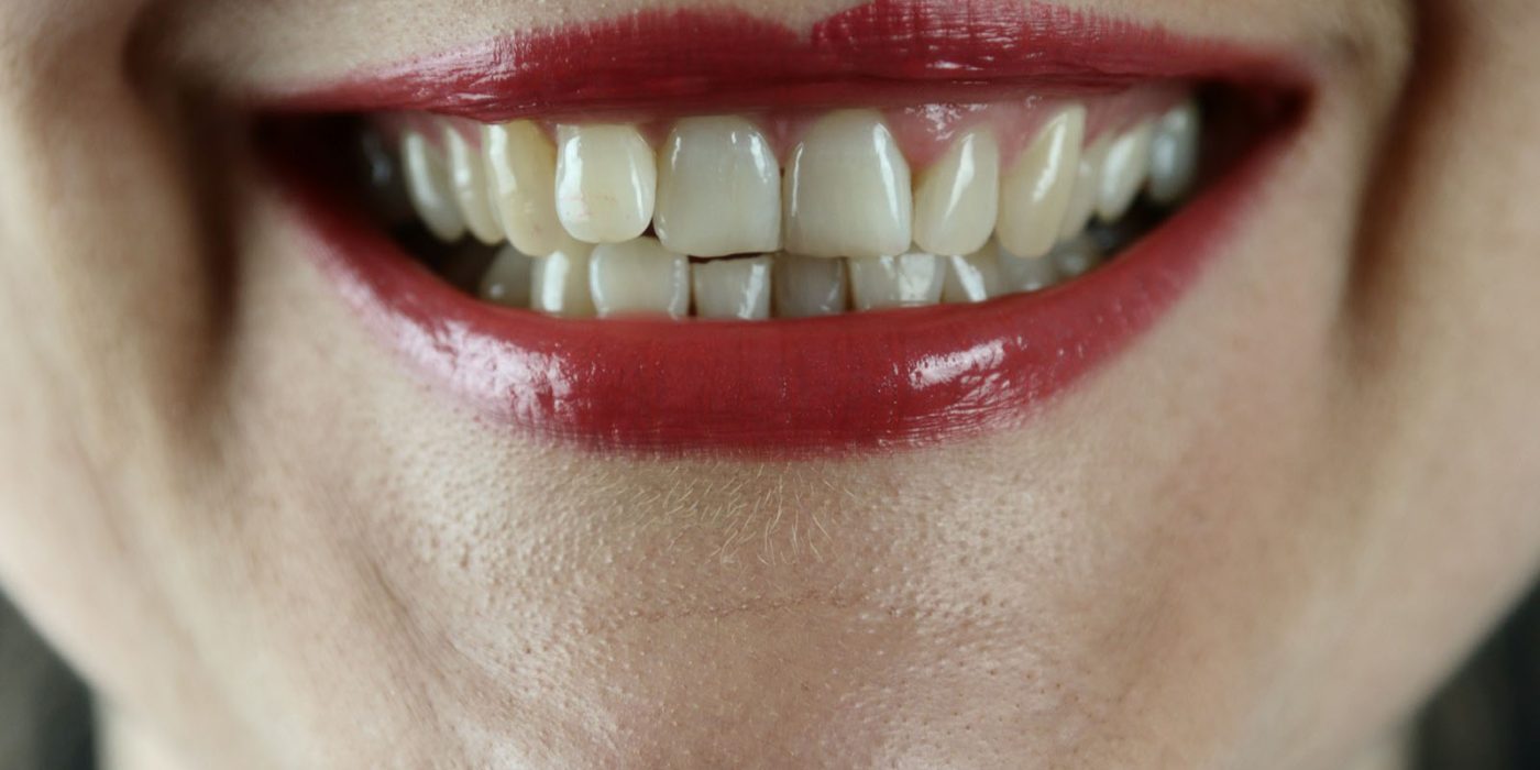 OCCLUSIONE DENTALE E POSTURA (1)